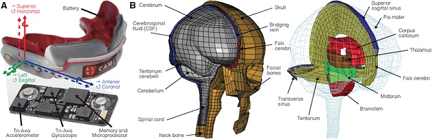 Measurement of head biomechanics and simulation of brain deformation. a Head accelerations during impact were measured in six-degree-of-freedom (6DOF) measurements using instrumented mouthguards. Mouthguard measurements were used in a simulation consisting of a b finite element head model incorporating the scalp, skull, brain, cerebrospinal fluid, and bridging veins