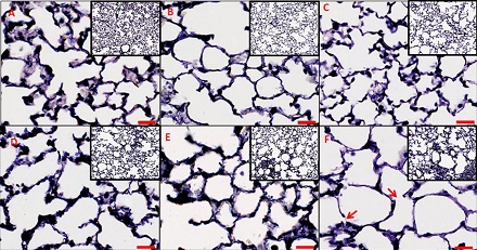 CAPTION Lung tissue histology.