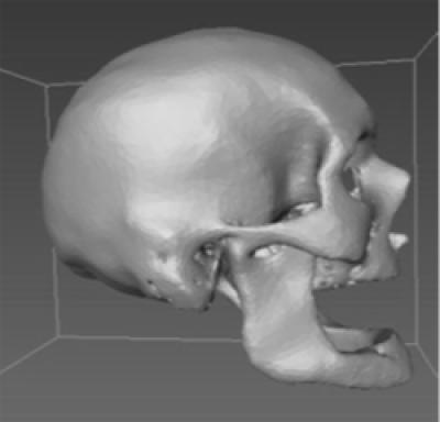 Study: CT scans could bolster forensic database to ID unidentified remains