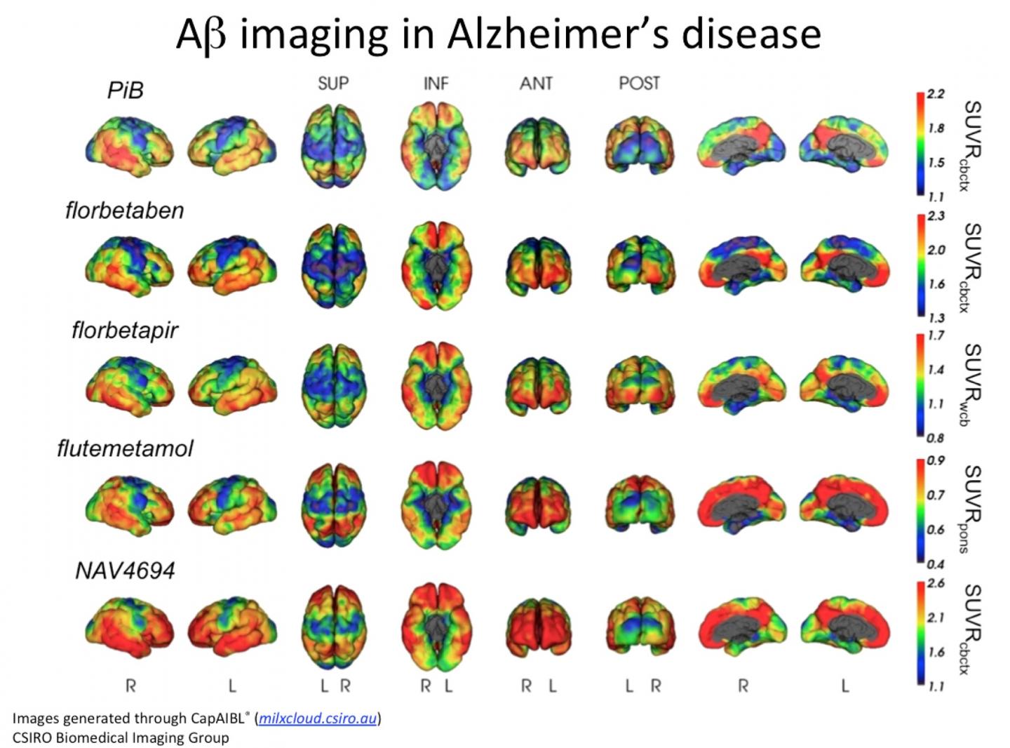 These images were generated through the CapAIBL CSIRO Biomedical Imaging Group.