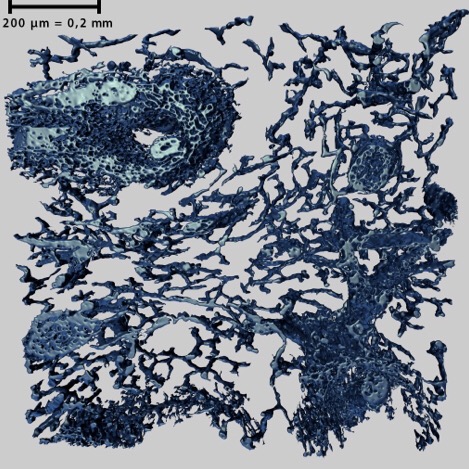 3D-reconstruction of blood vessels in the spleen. Image: Oleg Lobachev