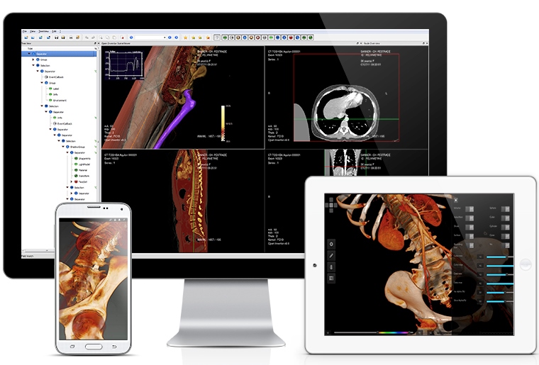 FEI releases RemoteViz