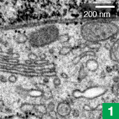 Using specialized electron microscopes, scientists capture thousands of images of cells, layer by layer.