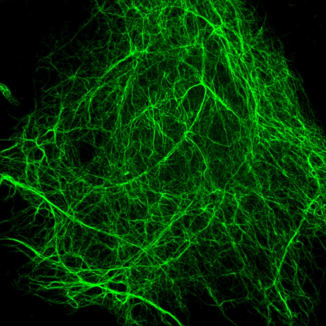 The protein vimentin (green) helps protect a cell’s nucleus and DNA during migration. (Image courtesy of Maxx Swoger)