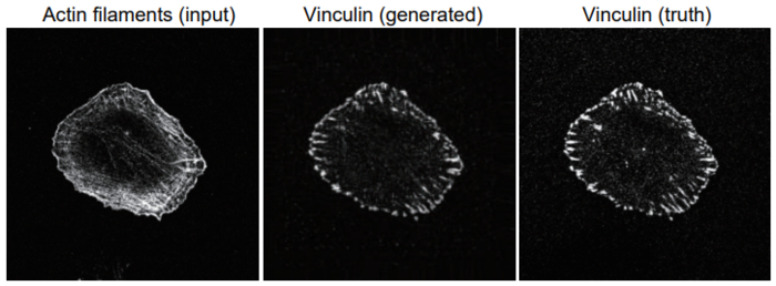 An example of a generated image of focal adhesion protein (vinculin) (center), which anchors actin filaments, from an image of actin filaments (left). The true vinculin image is also shown (right).  CREDIT Shiro Suetsugu