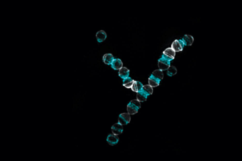 The synthetic antibiotic cilagicin was particularly active against Gram-positive bacteria such as Streptococcus pyogenes, depicted above.