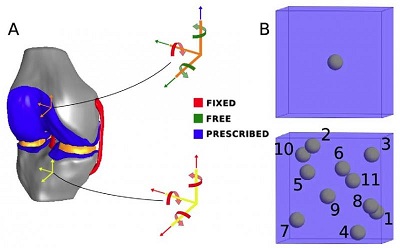 A macro-scale model of the knee (left) was created to study compressive loading of the joint. At the micro scale, the single-cell model (top, right) has been used in previous studies, while Erdemir’s 11-cell model better represents the effects of loading on the individual cells. (Erdemir/Cleveland Clinic)