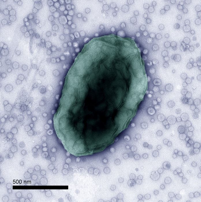 Bacteroides thetaiotaomicron cell releasing Bacterial Extracellular Vesicles (BEVs), which are tiny packages created by bacteria that they fill with various molecules and release from the cell.  CREDIT Image by Rokas Juodeikis (Quadram Institute) and Ian Brown (University of Kent), credit Catherine Booth at Quadram Institute.