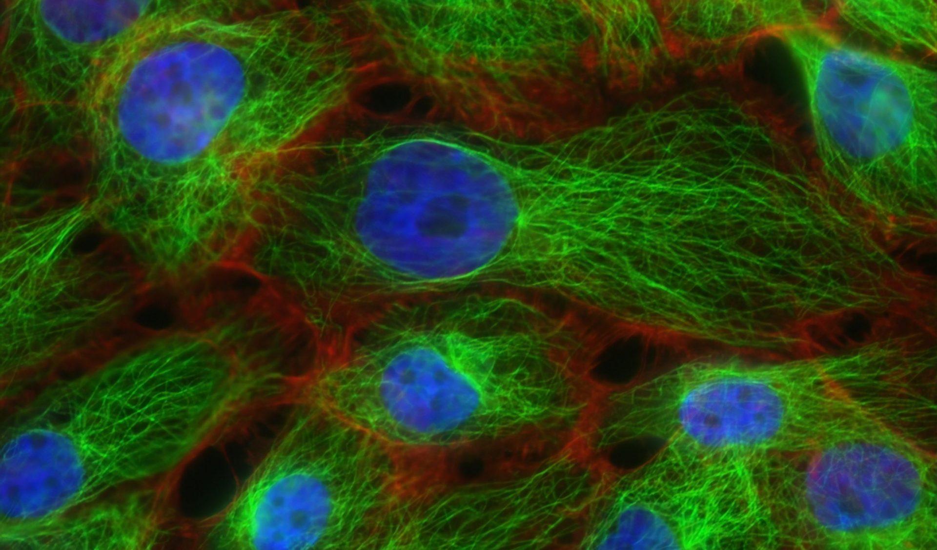Currently only leading experts can tell between cancer cells.