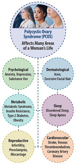 What evidence did the NIH study provide to show that AI/ML can successfully diagnose Polycystic Ovary Syndrome?