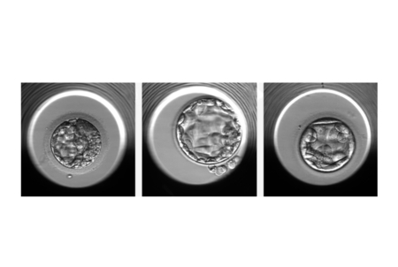 Examples of embryos evaluated by the STORK-A algorithm. From left to right, an embryo predicted to have a normal chromosome count or a single chromosomal abnormality;  an embryo predicted to have a normal chromosome count; an embryo predicted to have more than one chromosomal abnormality.